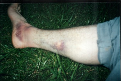 England2000_0011_Injury.jpg